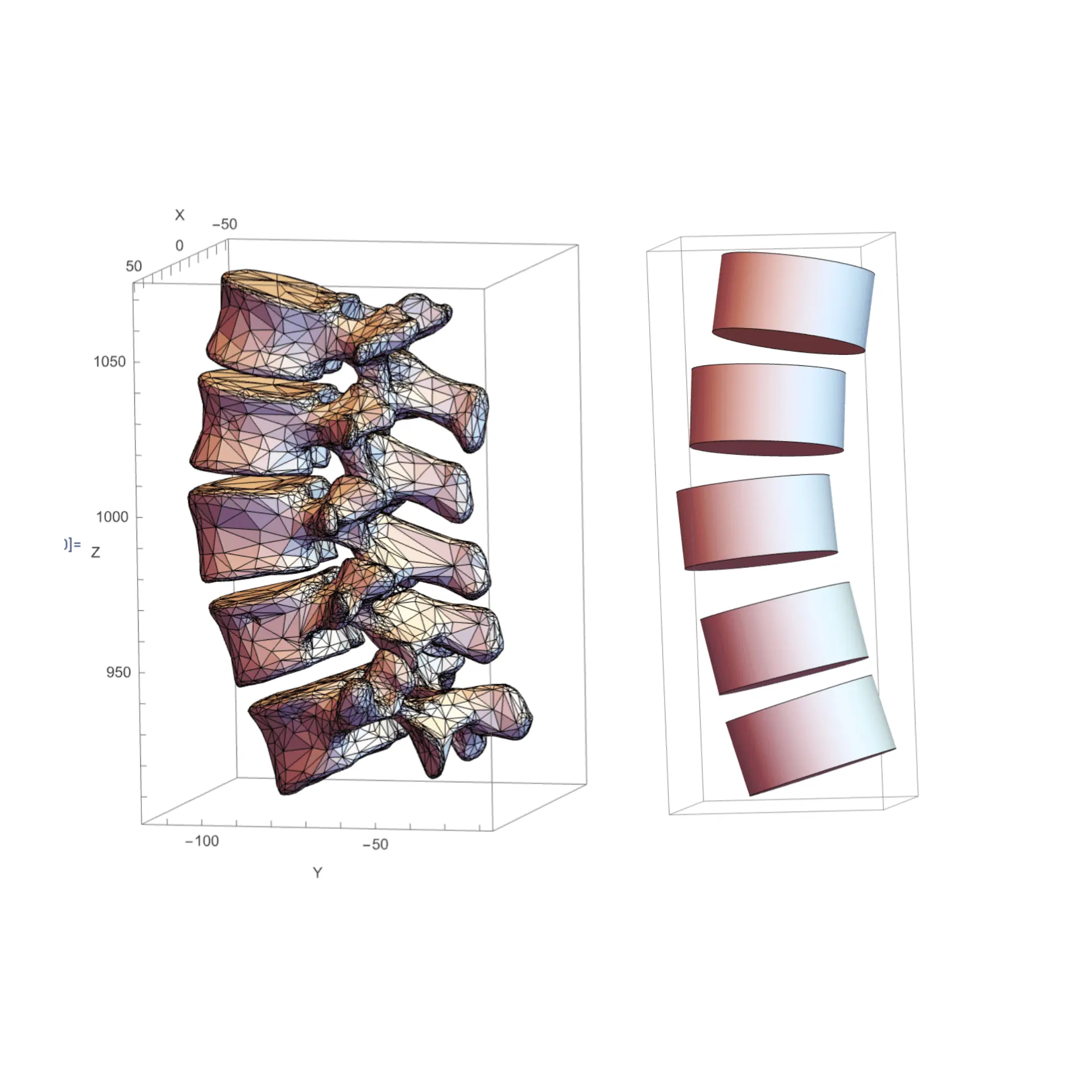 Modeling Lumbar Spine Posture and Scoliotic Deformation with Proprioceptive Feedback